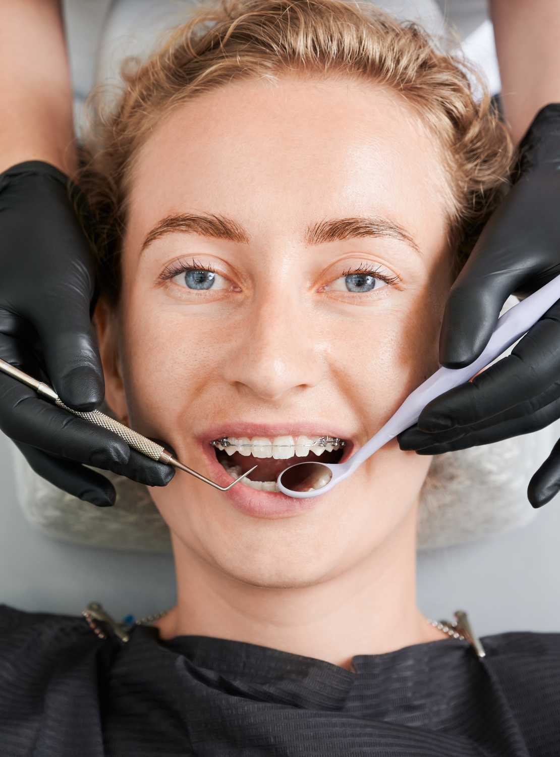 dentist-examining-woman-teeth-with-braces (1)